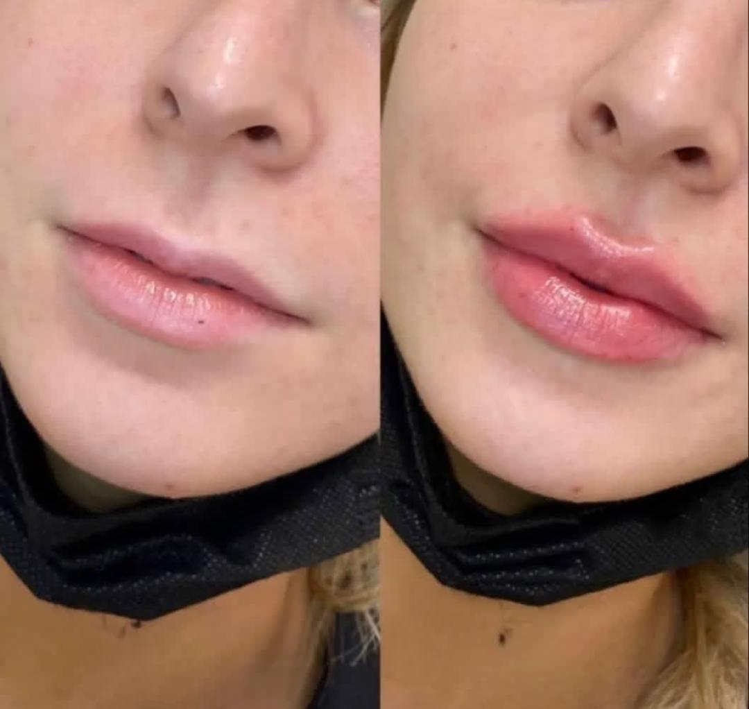 مطب زیبایی کوثر در تبریز